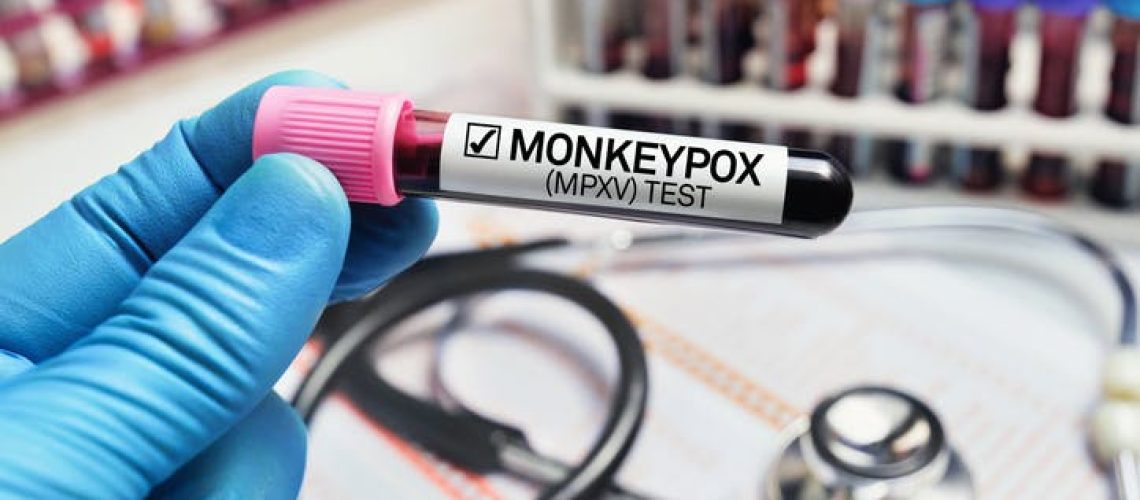 Tout savoir sur la variole du singe (Mpox) : transmission, vaccin, symptômes… Tout savoir sur la variole du singe (Mpox) : transmission, vaccin, symptômes…